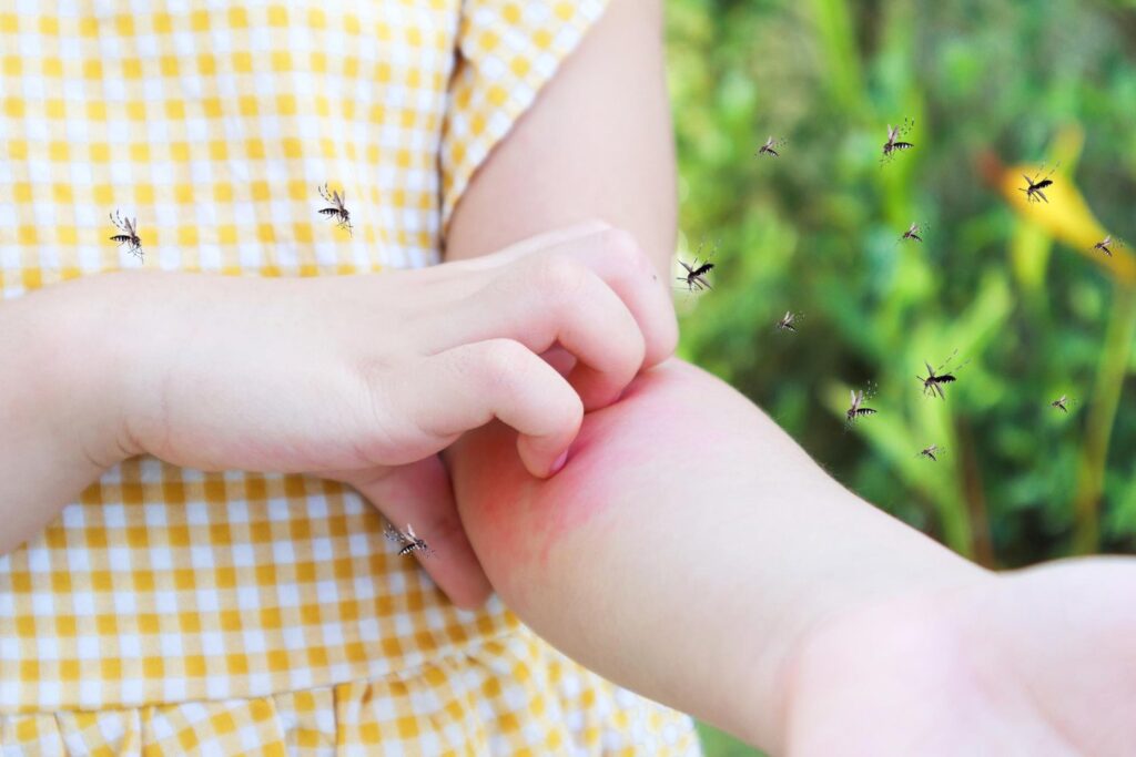 A child in a yellow checkered dress scratches a red, irritated spot on their arm while surrounded by flying mosquitoes outdoors.