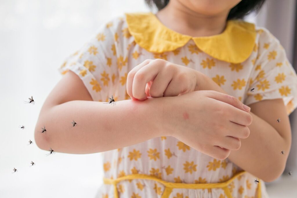 girl scratching her arm because of mosquito bites