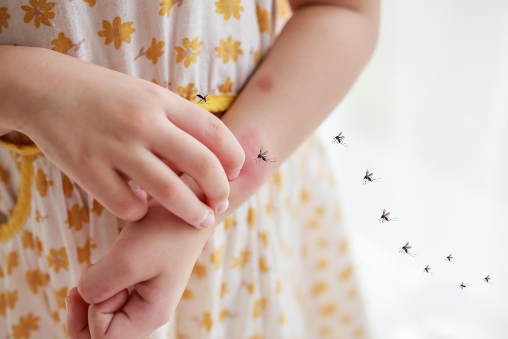 girl scratching her arm due to mosquito bites